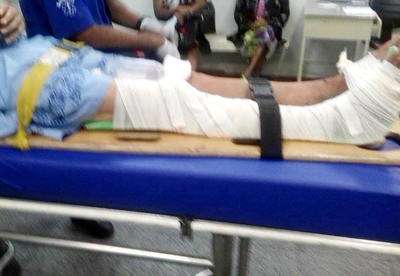 Homem de 57 anos fica ferido após cair de escada em Pipeiras
