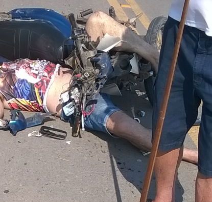Queda de moto deixa casal ferido em SJB