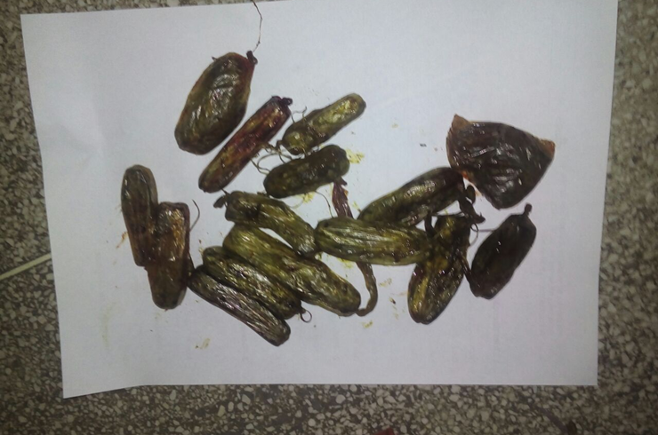 Médicos encontram maconha em intestino de homem