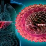 Caso de hepatite tóxica alerta para produtos que prometem emagrecer