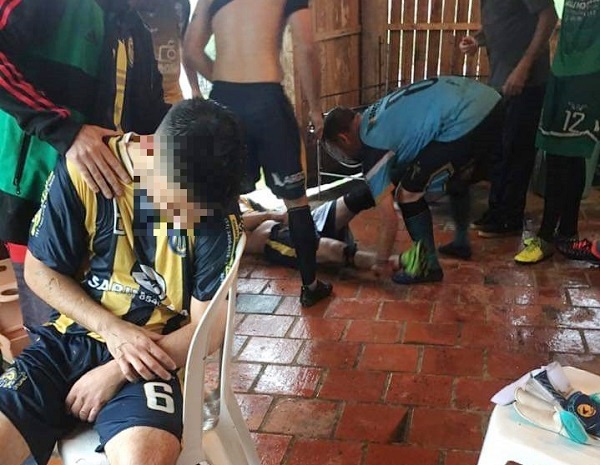 Queda de raio deixa um morto e 14 pessoas feridas em RS