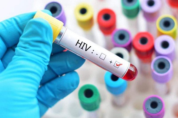 Homem do Reino Unido é o segundo curado de HIV no mundo