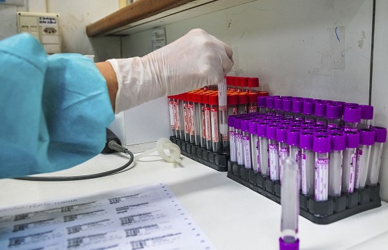 Hospital investiga se pacientes foram reinfectados pelo coronavírus