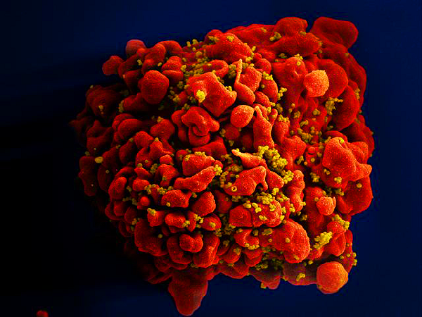 Fiocruz: estudo aponta medicamento de ação prolongada contra HIV