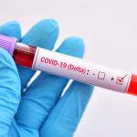 Brasil tem 143 casos da variante Delta do novo coronavírus