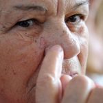 Brasileiros devem redobrar cuidados no verão contra câncer de pele