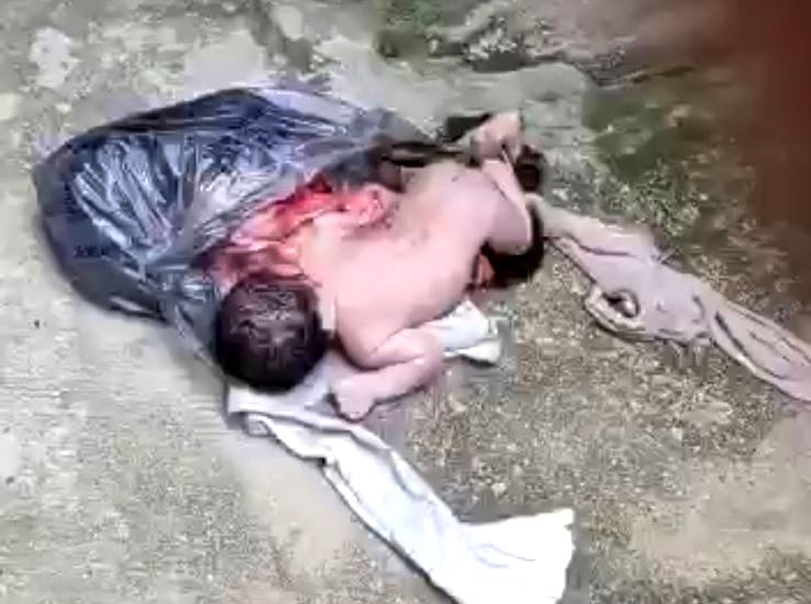 Vídeos – Recém-nascida é encontrada viva em sacola de lixo no RJ