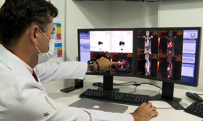 Inca prevê 44 mil casos novos de câncer colorretal no Brasil por ano
