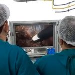 Vídeo - Santa Casa de SJB realiza primeira cirurgia de retirada da vesícula biliar através da videolaparoscopia