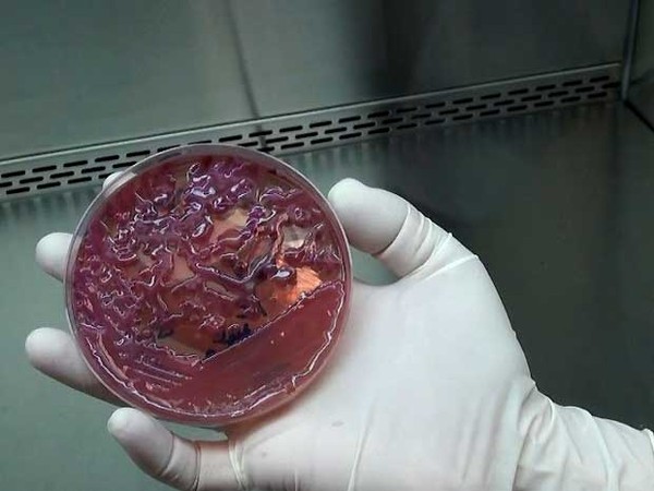 Campinas identifica superbactéria em 7 pacientes e fecha UTI do Mário Gatti temporariamente