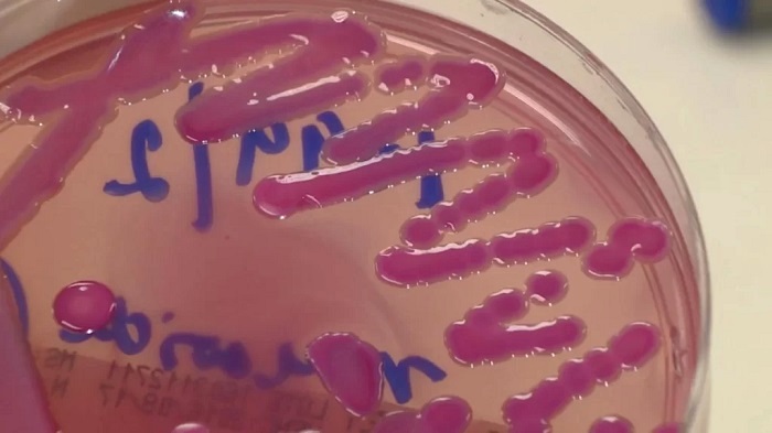 Perigosa superbactéria KPC, resistentes a antibióticos, acende alerta em hospitais e exige reforço nos protocolos de controle de infecção